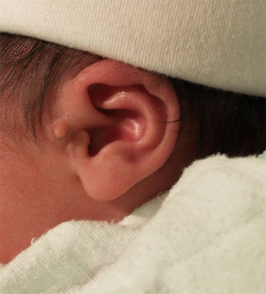 eartag1 Janelle ABy, MD STanford.jpg